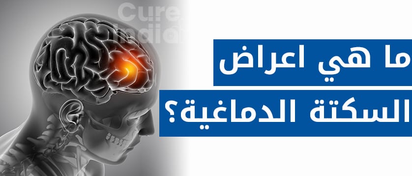 ما هي اعراض  السكتة الدماغية؟